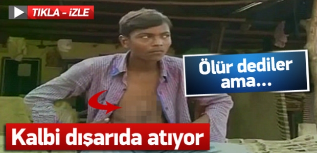 Kalbi dışarıda atan çocuk