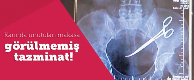 Karında unutulan makasa görülmemiş tazminat!