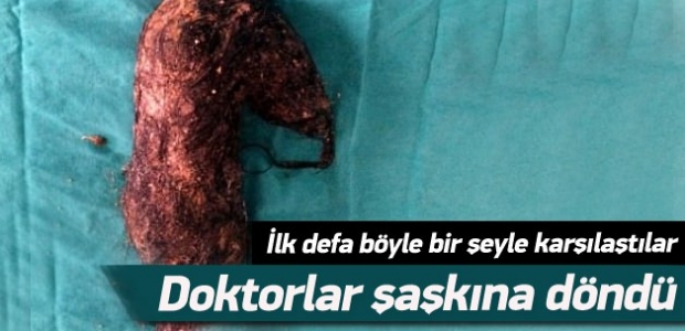 Doktorlar bile hayrete düştü!