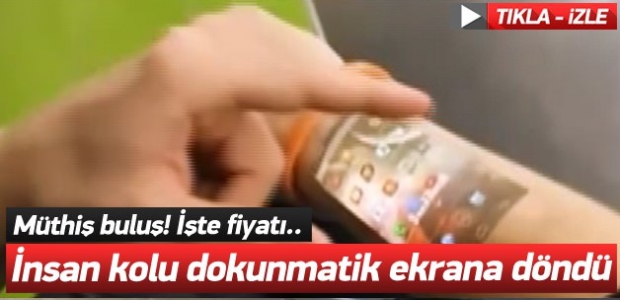 İnsan kolu akıllı telefona döndü!