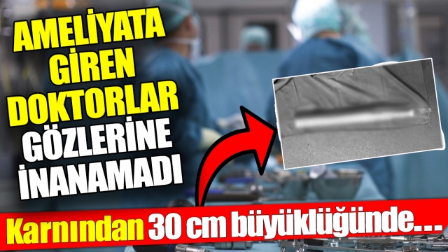 Ameliyat Eden Doktorlar Şaşkına Döndü