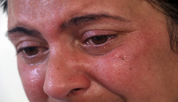 'Bembeyaz dişlerim olsun' istedi, 32 dişinden oldu 