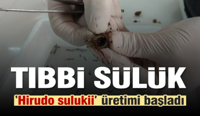 Bu Tıbbi Sülükler Isparta'da üretiliyor!