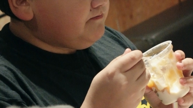 Çocukluk çağı obezitesine karşı eylem planı hazır