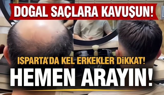 Isparta’da Saç Sorunlarına Doğal ve Şık Çözümler: Yüksel Hair Concept ile Kendinizi Yenileyin