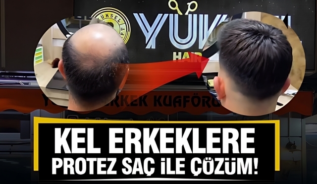Isparta’da Yüksel Hair Concept ile Doğal ve Kaliteli Protez Saç Hizmeti
