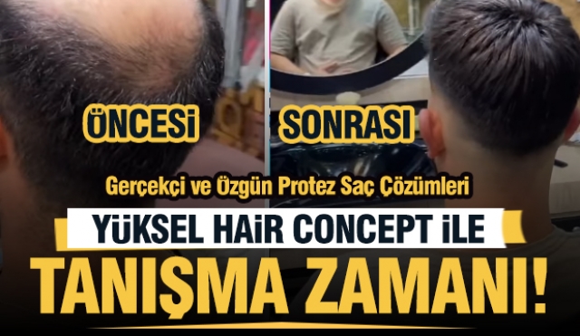 Isparta'da Gerçekçi ve Özgün Protez Saç Çözümleri