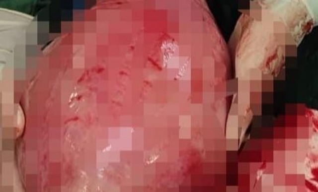 Isparta'da hasta gerçeği öğrenince şok oldu doktorlar şaştı kaldı