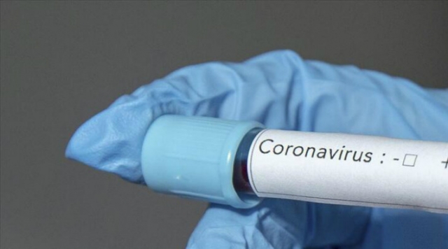 Koronavirüs şüphesinde ne yapmalı? ne zaman hastaneye gidilmeli?