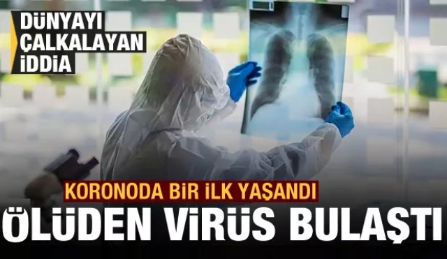 Koronavirüste bir ilk! Ölen bir kişiden başka bir insana virüs bulaştı