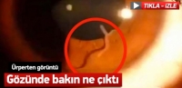 BAKIN KADINININ G&Ouml;Z&Uuml;NDEN NE &Ccedil;IKTI VİDEO HABER
