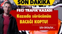 Isparta'da Feci Kaza! Bacağı Koptu