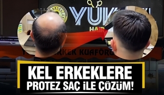 Isparta’da Protez Saçta Güvenin Adı: Yüksel Hair Concept