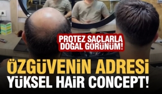 Özgüvenin Başkenti Isparta'da: Yüksel Hair Concept ile Saç Kaybına Doğal Çözümler!