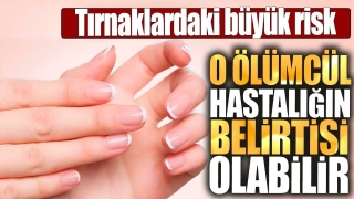 Tırnaklarınızda Fark Edilmeyen Tehlike Ne Olabilir?