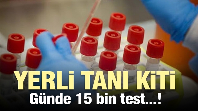 Türkiye'den gazete manşetleri - Yerli tanı kitiyle günde 15 bin test